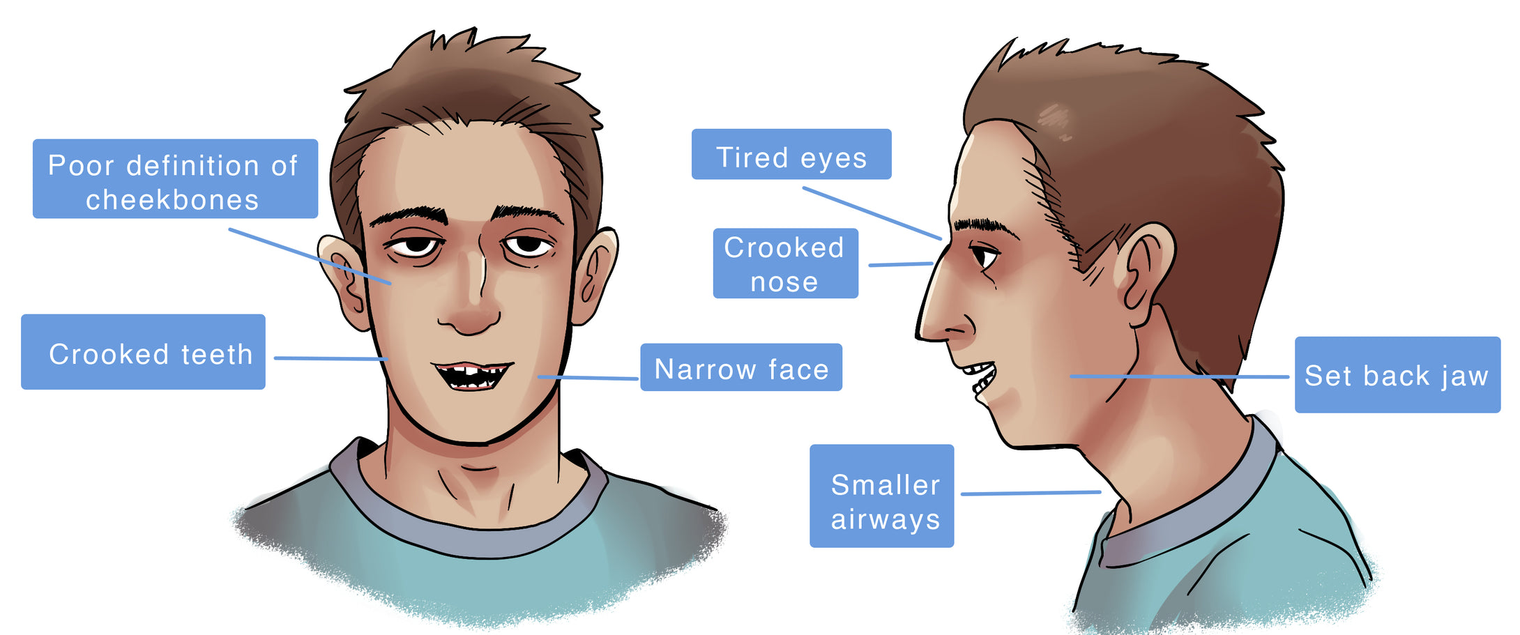Mewing Step By Step Chart.pdf Mewing Ring - A device that improves your facial appearance